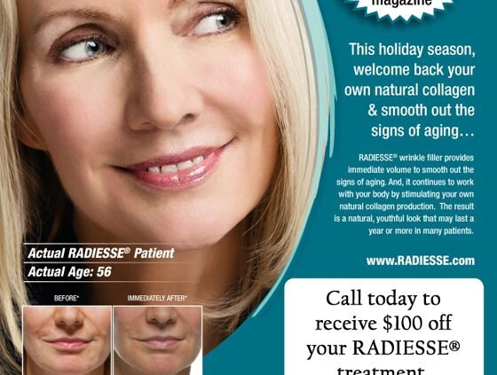 100 off radiesse
