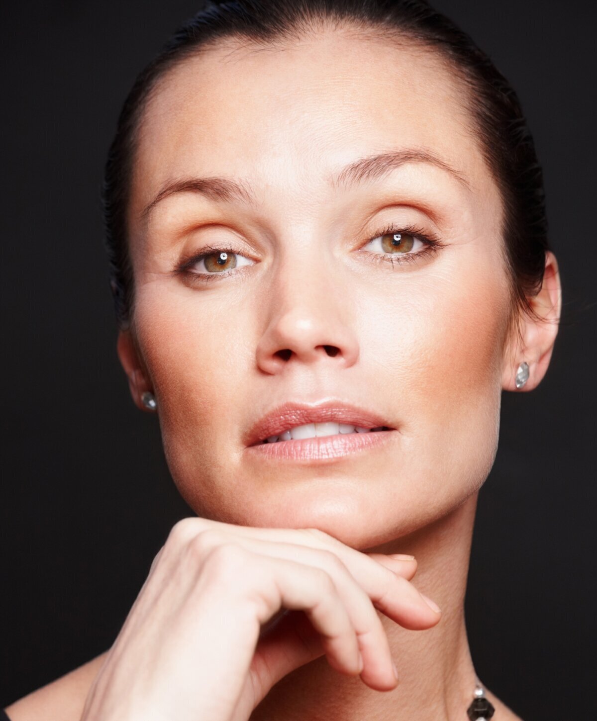 Kansas City chemical peel model with grey hair